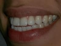 Konig Center for Cosmetic & Comprehensive Dentistry smile photos